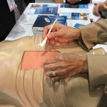 Procedure for AF